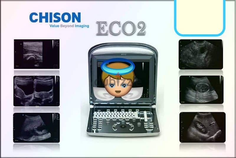 سونار شيزون ultrasound chison eco2 3