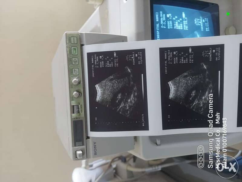 برنتر سونار ultrasound vedio printer 1