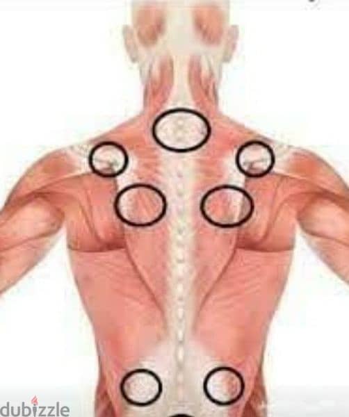 حجامة طبية وعلاجية 0