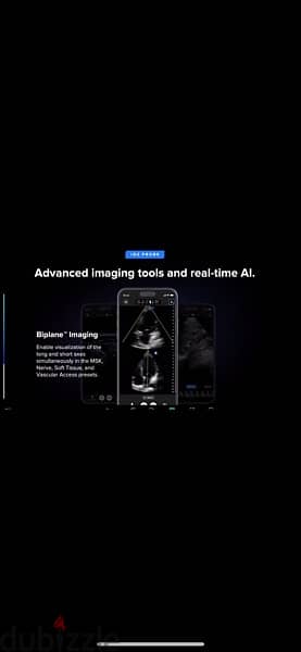 butterfly IQ ultrasound probe 6