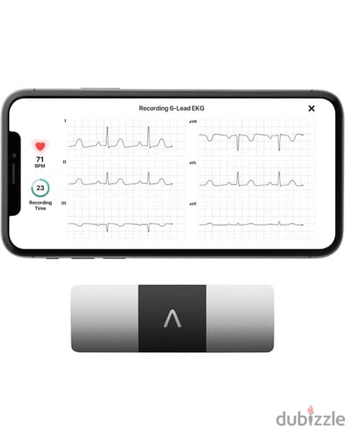 Pocket ECG EKG Device 0