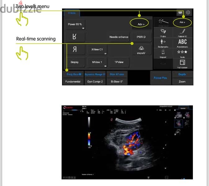 جهاز ايكو Echocardiography 2