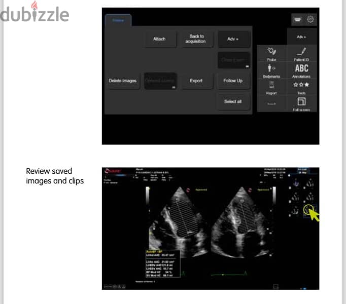 جهاز ايكو Echocardiography 3