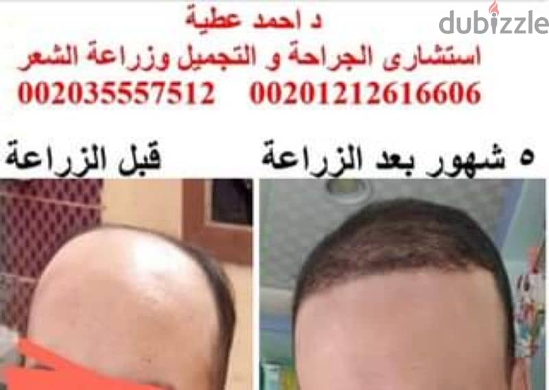 عيادة الدكتور  احمد عطية
استشارى الجراحة العامة
والتجميل و الشعر 3