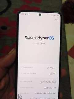 شاومي Redmi Not 11 0