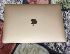 MacBook