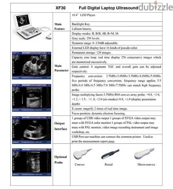 سونار ultrasound portable  Minyang XF30 Full Digital Laptop 1