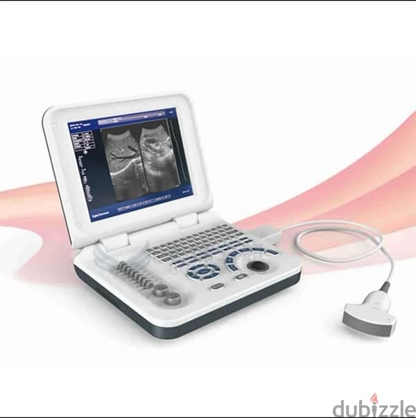 سونار ultrasound portable  Minyang XF30 Full Digital Laptop 2