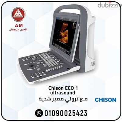 سونار شيزون إيكو 1  Chison ECO 1