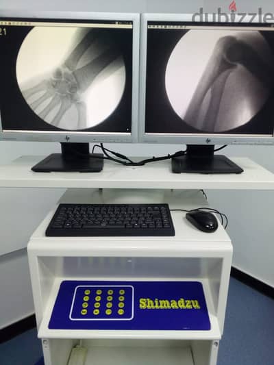 ليه تبيع جهازك القديم ( C-ARM ) لما ممكن تخليه جهاز حديث موديل السنه