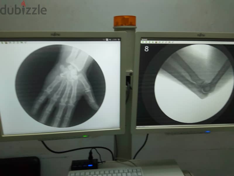 ليه تبيع جهازك القديم ( C-ARM ) لما ممكن تخليه جهاز حديث موديل السنه 3