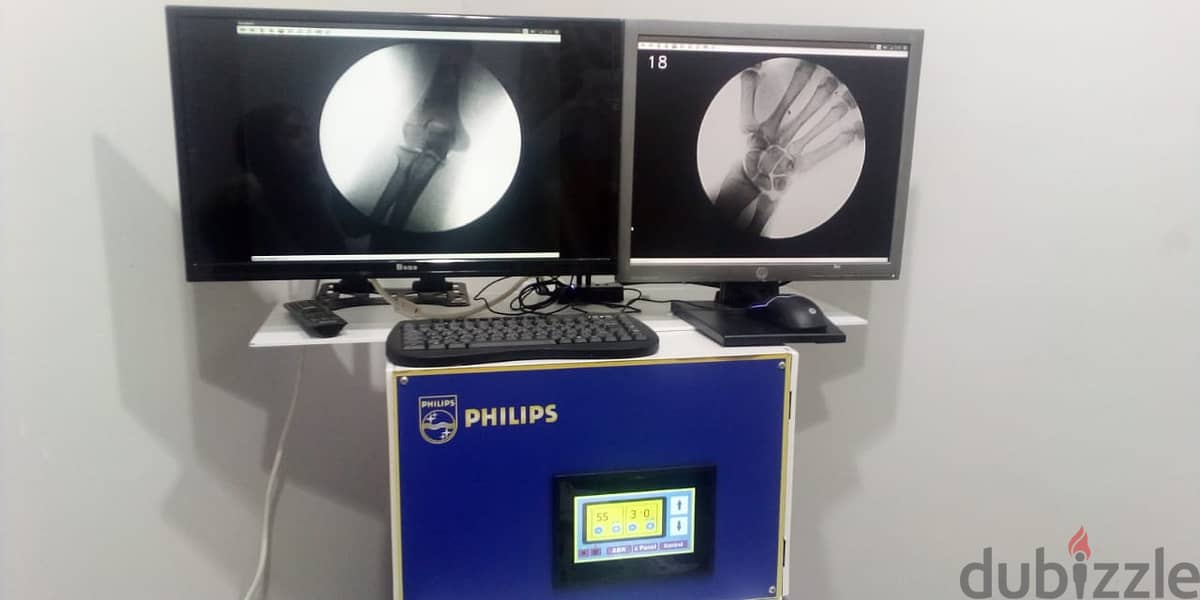 ليه تبيع جهازك القديم ( C-ARM ) لما ممكن تخليه جهاز حديث موديل السنه 11