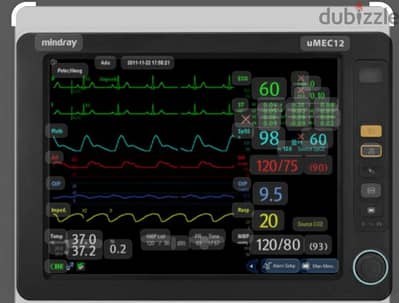 جهاز مونيتور مندراي umec12