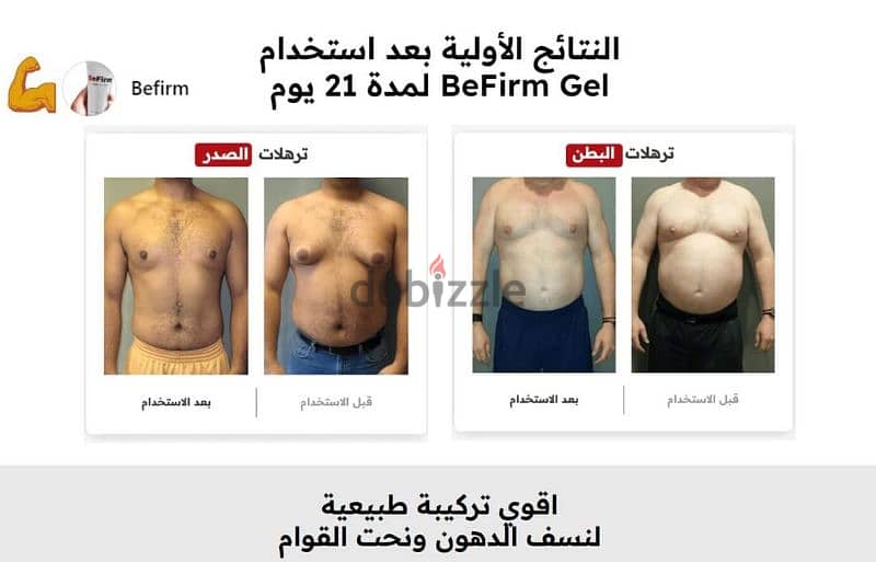 منتج التخسيس الجباااار  Befirm Gel 0