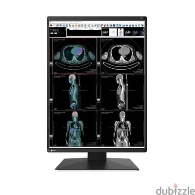 RX250 2MP 21.3" LCD Medical Display - RadiForce  EIZO‏