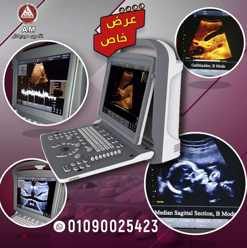 سونار شيزون Chison ECO 1 Ultrasound أبيض و أسود 0