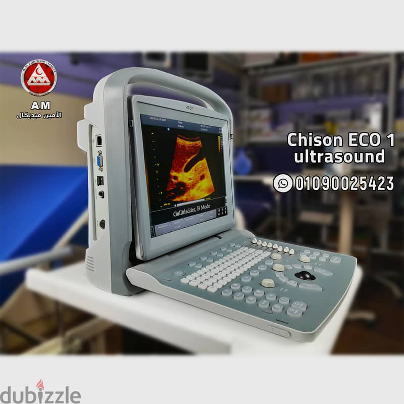 جهاز سونار شيزون ايكو 1  Chison ECO 1 0