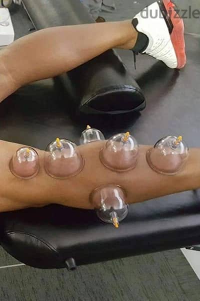 أخصائية طب تكميلي جميع انواع الحجامه كاسات هواء فوطه ناريه