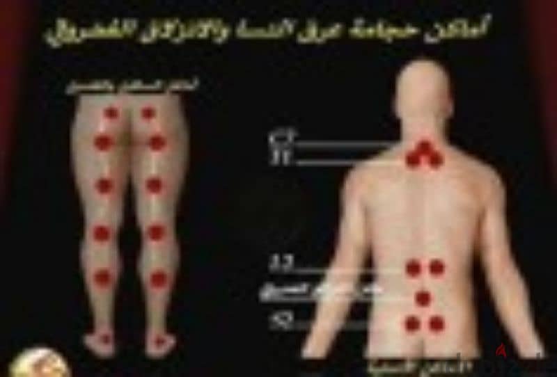 أخصائية طب تكميلي جميع انواع الحجامه كاسات هواء فوطه ناريه 3