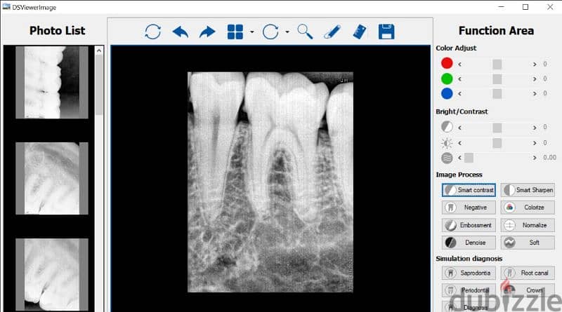 rundeer sensor + allengers x ray 0