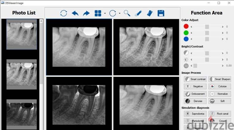 rundeer sensor + allengers x ray - مستلزمات طبية - 203358958