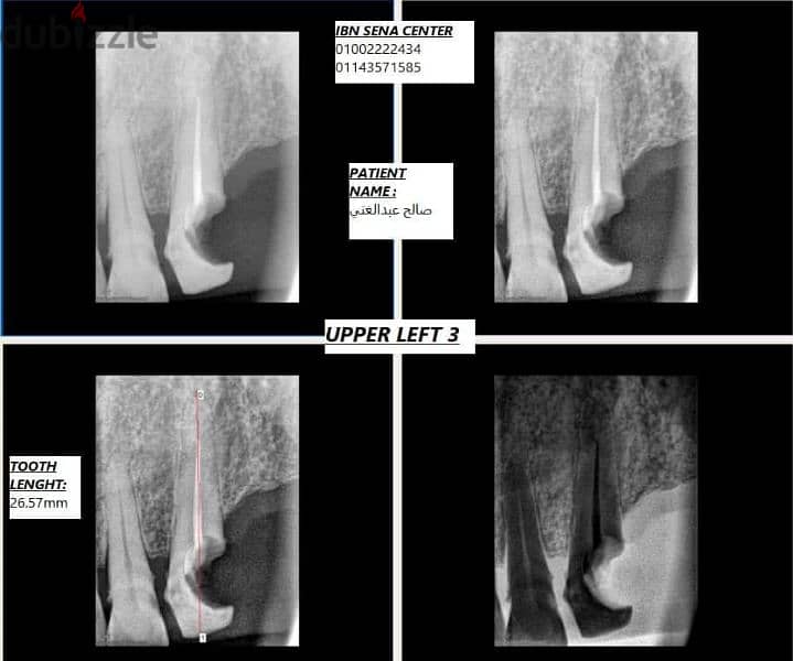 allengers floor mounted x ray 4