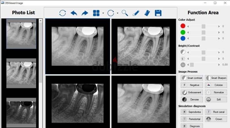 allengers floor mounted x ray 5