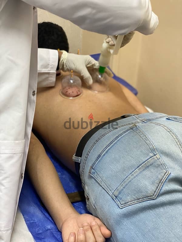 جلسات علاج طبيعي - حجامه - ابر صينيه 1