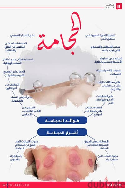 حجامه علاجيه اسكندرية