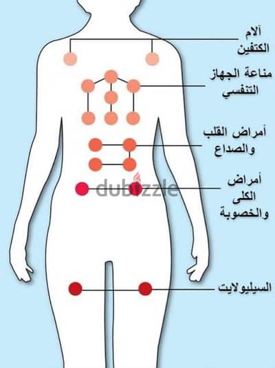 العلاج والاسشفاء بالحجامة والابر الصينية