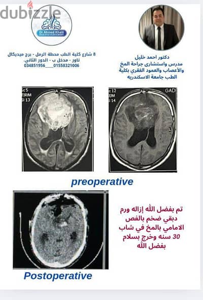 مخ واعصاب