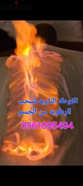 حجامه وقائيه وعلاجيه 2