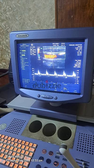 4D color Doppler ultrasound