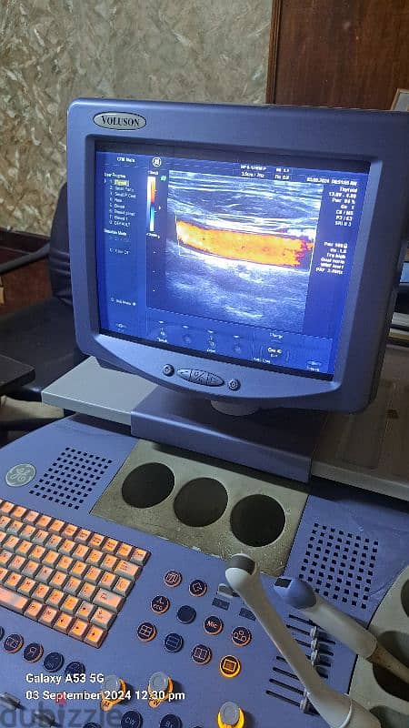 4D color Doppler ultrasound 2