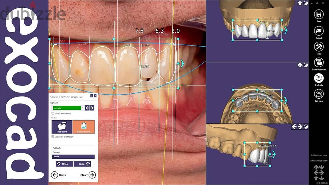 exocad 3.2 software download 1