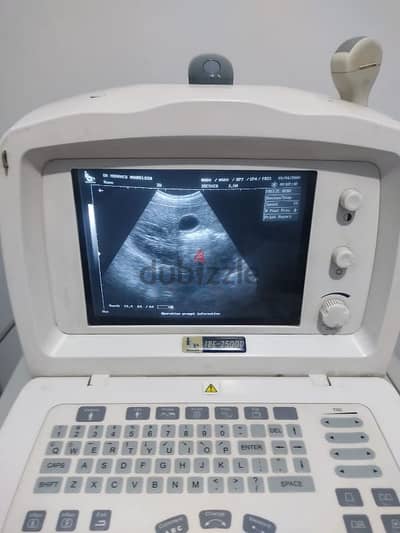 سونار ميندراي. . . ultrasound mindray