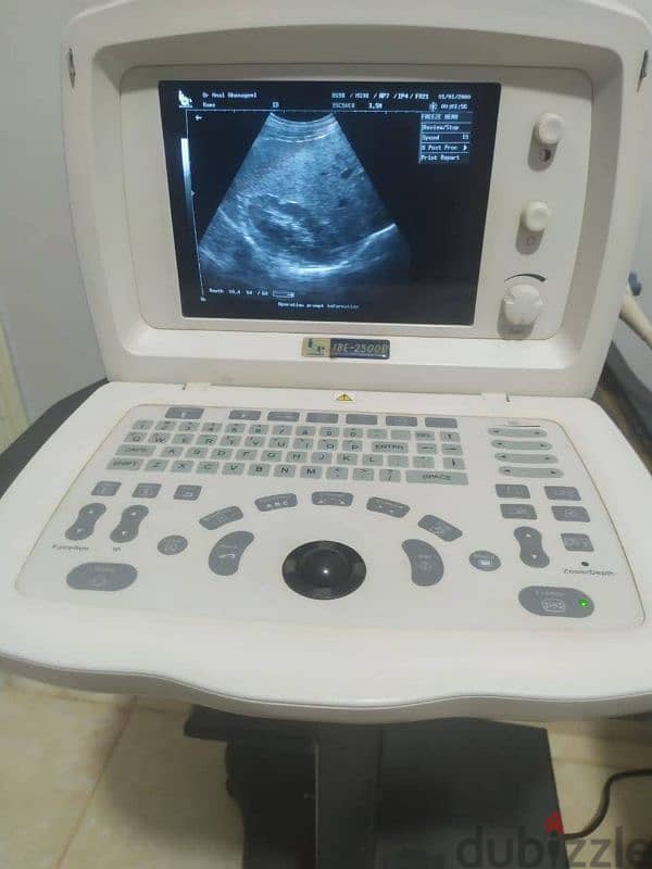 سونار ميندراي. . . ultrasound mindray 2