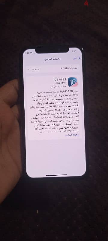 اتنين ايفون x وxs 5