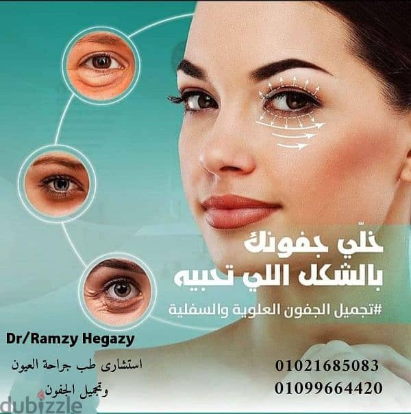 عمليات تجميل العيون 2