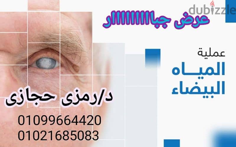 عمليات تجميل العيون 3