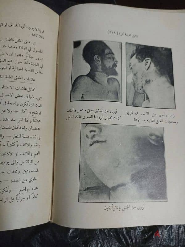 كتاب نادر وصعب تحصيله كامل كنسخة أصلية وبحاله جيدة كتاب الطب الشرعي 3