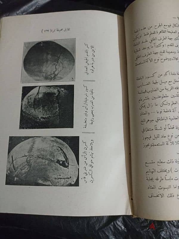 كتاب نادر وصعب تحصيله كامل كنسخة أصلية وبحاله جيدة كتاب الطب الشرعي 7