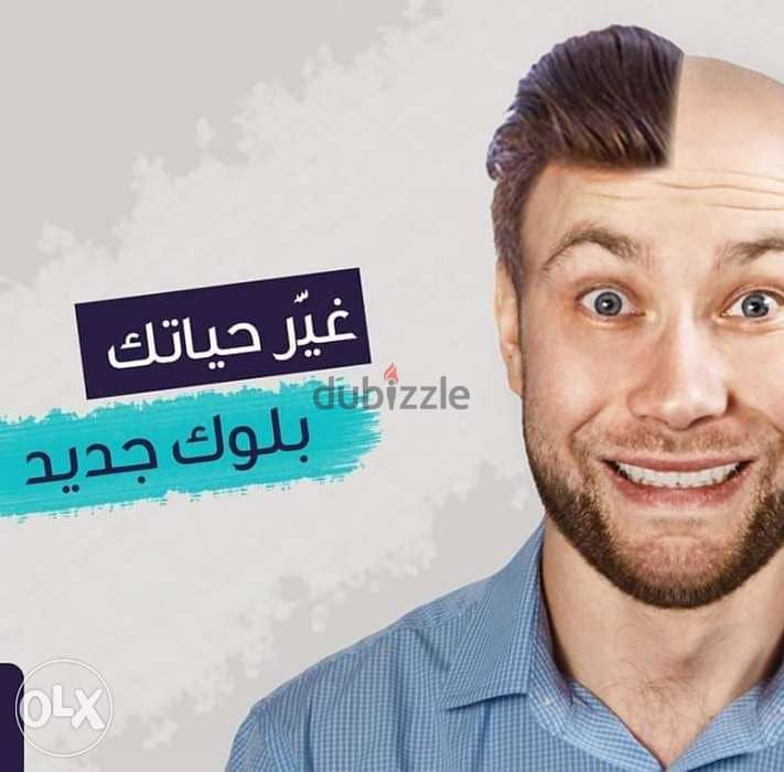 الشبكيه افضل طرق لإخفاء الصلع الوراثي 0