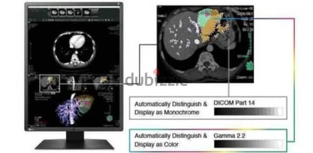 RX250 2MP 21.3" LCD Medical Display - RadiForce | EIZO‏