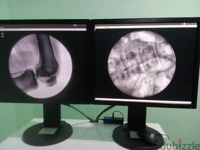 تتشرف شركة MS Medical بتقديم أحدث إبتكاراتها في عالم أجهزة C-ARM