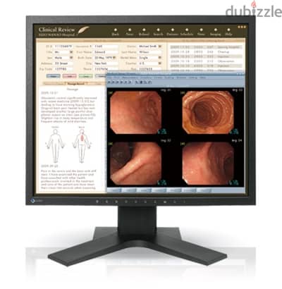 شاشة EIZO RadiForce MX191