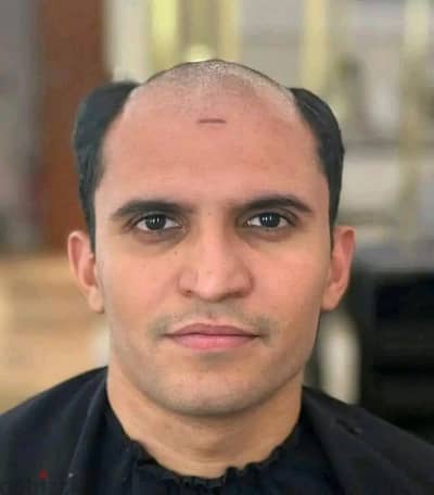 الشبكية الفرنسية الاصلية جزور طبيعي في المعادي