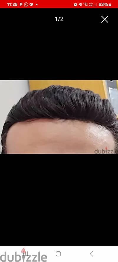 شبكيه للشعر