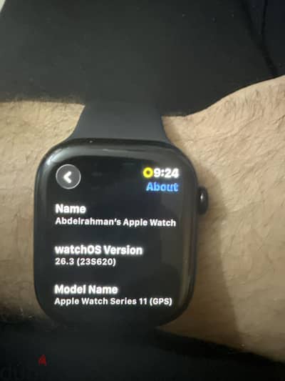Apple watch series 11