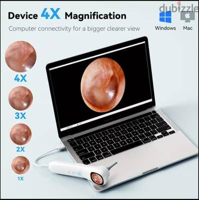 Ear and Nose Otoscope